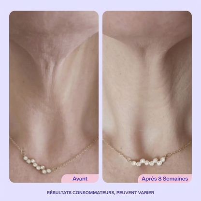 Un cou plus ferme et lisse en 4 semaines - ou remboursé